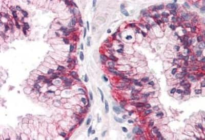 Immunohistochemistry-Paraffin: ATPase Na+/K+ beta 3 Antibody [NBP3-14545] - Immunohistochemistry of formalin-fixed, paraffin-embedded human prostate tissue after heat-induced antigen retrieval.